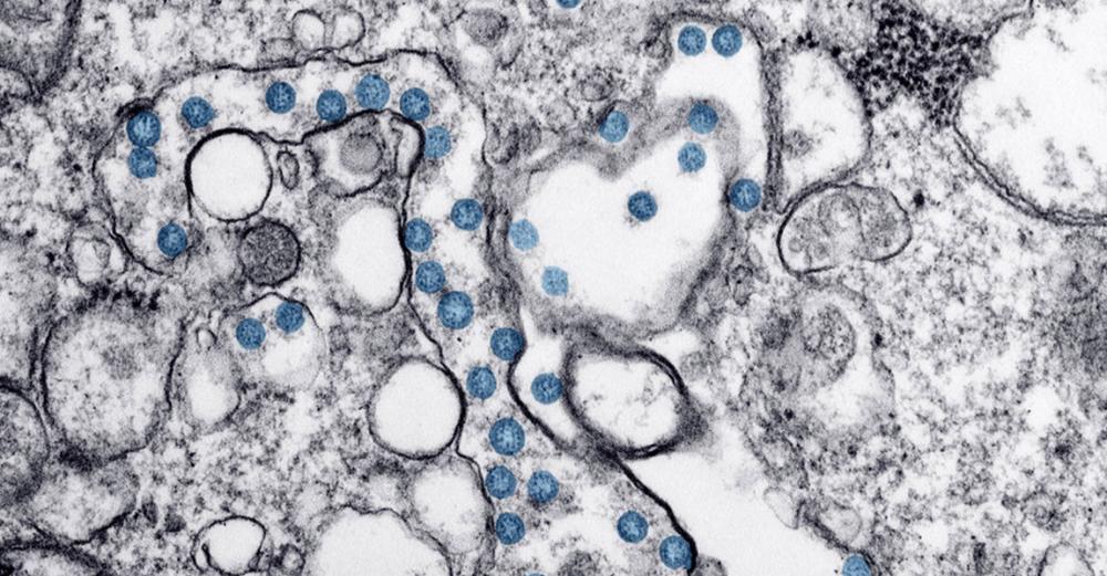 COVID-19 reinfection seems not to be a &lsquo;regular event&rsquo;, says UN health agency