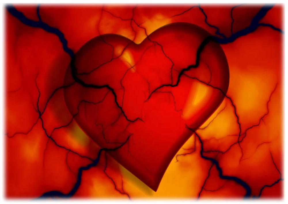 Study shows 1 in 3 adults with Type 2 diabetes may have undetected cardiovascular disease