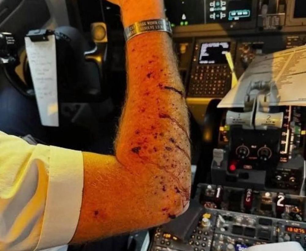 US: Boeing 737 MAX 8 windshield shatters mid-air, suffers 10,000-foot drop after an unidentified object strikes; pilot hurt